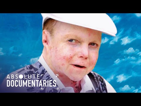 The 36-Year-Old Man In a Child's Body (Extreme Medical Documentary) | Absolute Documentaries