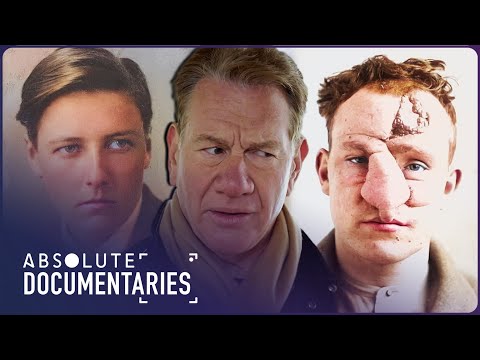 The Legacy of Cambridge Military Hospital's Plastic Surgery Pioneers | Absolute Documentaries